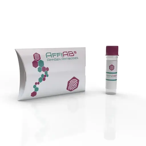 [ABD2467] MIXL1 Antibody
