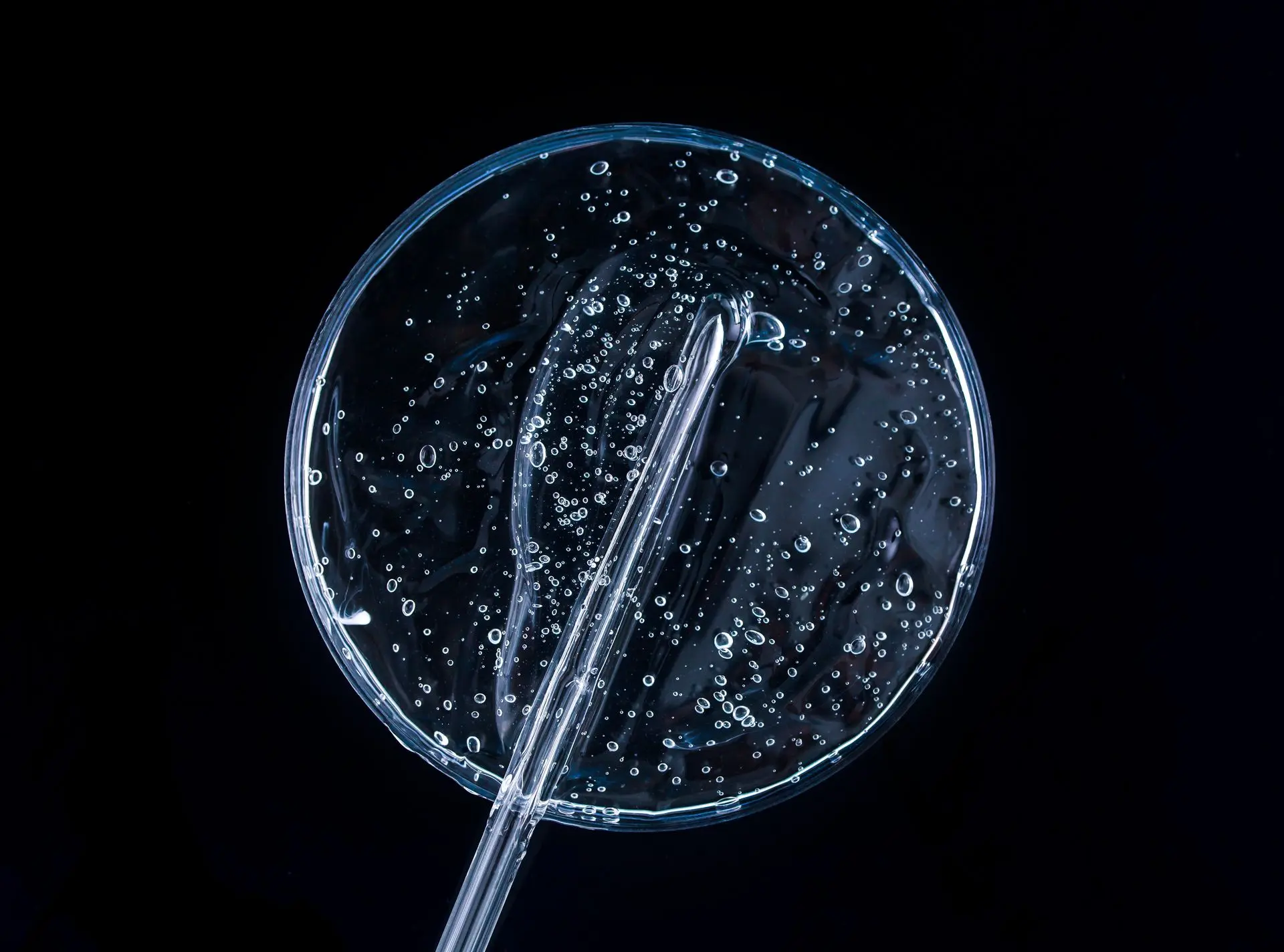 Diagnosis of Infectious Diseases IDdx